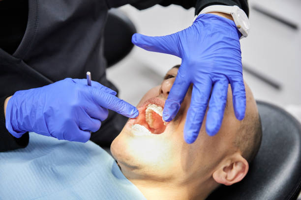 Best Emergency Dental Care for Sports Injuries in Bridgeport, TX